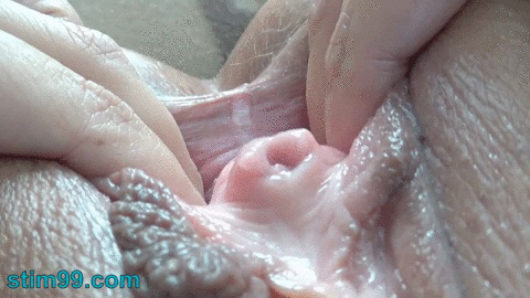 Peehole and sounding GIFs — 19