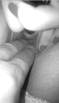 Peehole and sounding GIFs — 22